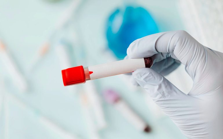 whitworth-medical-centre-in-house-testing